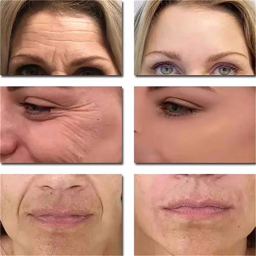 Instant Wrinkle Remover